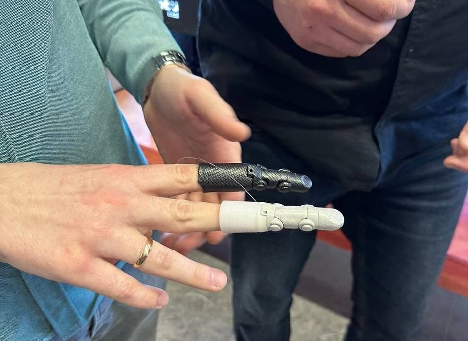 Первые в мире: резидент «Жигулевской долины» вывел на маркетплейс тяговые протезы пальцев